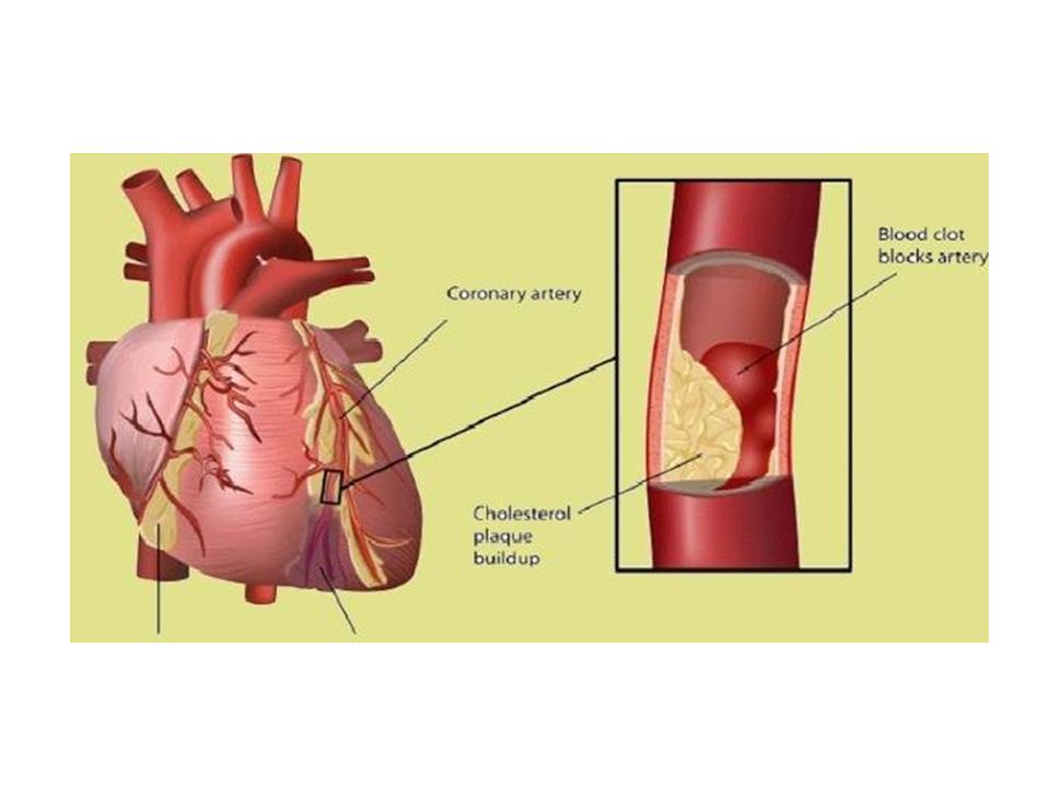 What Causes Bad Blood Circulation